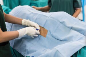 Spinal and Epidural Anesthesia